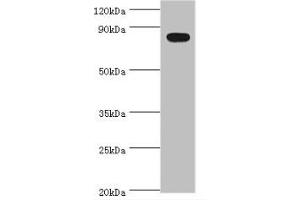 Western blot, All lanes: BACH1 antibody at 2ug/ml + Mouse thymus tissue. (BACH1 抗体  (AA 1-320))