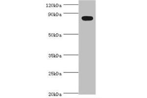 Western Blotting (WB) image for anti-BTB and CNC Homology 1, Basic Leucine Zipper Transcription Factor 1 (BACH1) (AA 1-320) antibody (ABIN6097748)