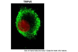 Immunohistochemistry (IHC) image for anti-Transient Receptor Potential Cation Channel, Subfamily V, Member 5 (TRPV5) (N-Term) antibody (ABIN2783755)