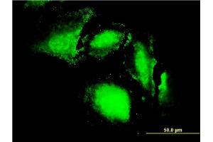 Immunofluorescence of monoclonal antibody to ERN1 on HeLa cell. (ERN1 抗体  (AA 401-500))