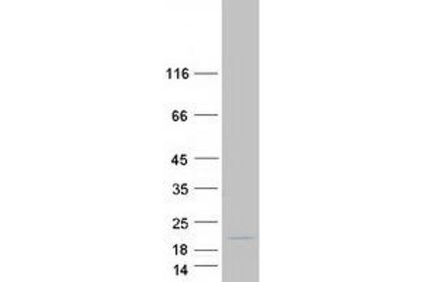 MRPL30 Protein (Transcript Variant 3) (Myc-DYKDDDDK Tag)