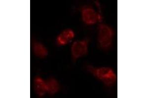 ABIN6276287 staining Hepg2 by IF/ICC. (alpha Fetoprotein 抗体  (C-Term))