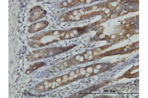 Immunostaining (ISt) image for anti-NADH Dehydrogenase (Ubiquinone) 1 alpha Subcomplex, 9, 39kDa (NDUFA9) (AA 303-377) antibody (ABIN561935)