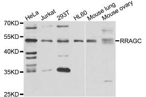 Western blot analysis of extracts of various cell lines, using RRAGC antibody. (GTR2 抗体)