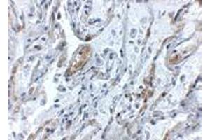 Immunohistochemistry (IHC) image for anti-Tumor Necrosis Factor, alpha-Induced Protein 3 (TNFAIP3) (Middle Region) antibody (ABIN1031138)