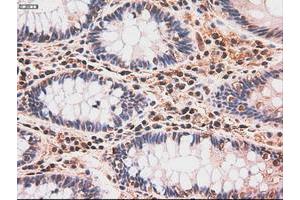 Image no. 5 for anti-Myc Proto-Oncogene protein (MYC) antibody (ABIN1497012) (c-MYC 抗体)