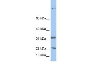 Selenoprotein antibody used at 1 ug/ml to detect target protein. (Sep 15 抗体  (Middle Region))