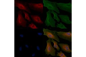 ABIN6264894 and ABIN6266632 staining  cells by IF/ICC. (S100A1 抗体  (N-Term))