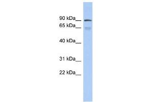 WB Suggested Anti-ZNF791 Antibody Titration:  0. (ZNF791 抗体  (Middle Region))