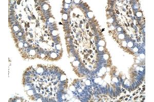 Complement C8b antibody was used for immunohistochemistry at a concentration of 4-8 ug/ml to stain EpitheliaI cells of intestinal villus (arrows) in Human Intestine. (C8B 抗体  (Middle Region))