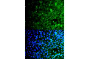 Immunofluorescence analysis of A549 cells using USP10 antibody (ABIN4905568). (USP10 抗体)
