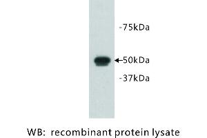 Image no. 1 for anti-FAT Tumor Suppressor Homolog 1 (FAT1) antibody (ABIN1112925) (FAT1 抗体)