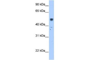 WB Suggested Anti-SLC35F5 Antibody Titration:  2.