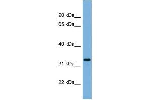 WB Suggested Anti-PEX11A Antibody Titration:  0. (PEX11A 抗体  (N-Term))