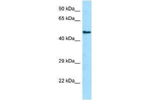 WB Suggested Anti-ANGPTL1 Antibody Titration: 1. (ANGPTL1 抗体  (N-Term))
