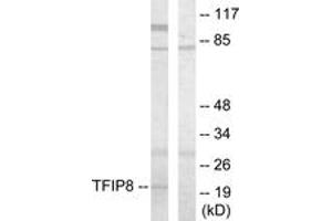 Western blot analysis of extracts from HuvEc cells, using TFIP8 Antibody.