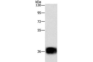 Western Blot analysis of Mouse heart tissue using CEBP epsilon Polyclonal Antibody at dilution of 1:500 (CEBPE 抗体)