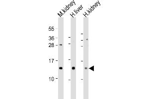 MTCP1 抗体  (AA 73-103)