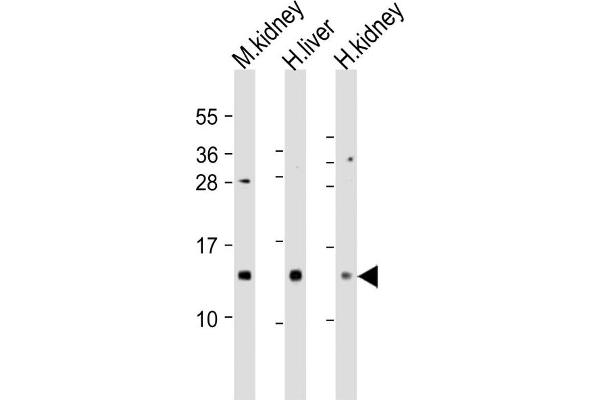 MTCP1 antibody  (AA 73-103)