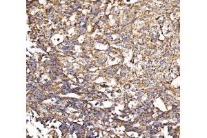 IHC analysis of MDH2 using anti-MDH2 antibody (ABIN7602618).