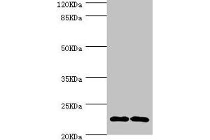 Western blot All lanes: CMPK1 antibody at 3. (Cytidine Monophosphate (UMP-CMP) Kinase 1, Cytosolic (CMPK1) (AA 37-196) 抗体)