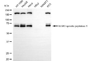 Western blotting analysis using SUMO specific peptidase 1 antibody (ABIN7800975). (Recombinant SUMO Specific Peptidase 1 抗体)
