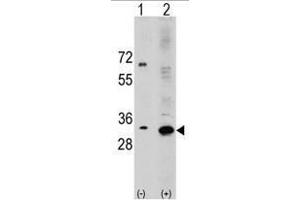 Image no. 3 for anti-Ribosomal Protein S6 (RPS6) (N-Term) antibody (ABIN357338) (RPS6 抗体  (N-Term))