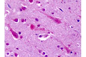 Anti-GRM7 / MGLUR7 antibody IHC of human brain, cortex. (GRM7 抗体  (N-Term))
