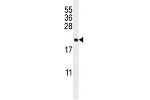 anti-UNQ3104 (AA 14-42) antibody