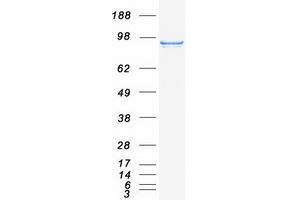 Western Blotting (WB) image for Signal Transducer and Activator of Transcription 6, Interleukin-4 Induced (STAT6) protein (Myc-DYKDDDDK Tag) (ABIN2732828)