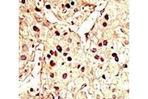 Immunohistochemistry (IHC) image for anti-Aurora Kinase B (AURKB) (AA 6-35) antibody (ABIN3030076)