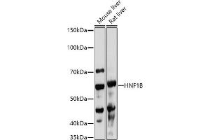 Western blot analysis of extracts of various cell lines, using HNF1B antibody (ABIN3017358, ABIN3017359, ABIN3017360, ABIN1680315 and ABIN1680316) at 1:1000 dilution. (HNF1B 抗体  (AA 100-200))