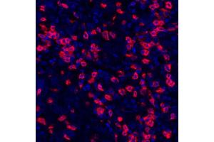 Immunofluorescence (IF) image for anti-CD8a Molecule (CD8A) (AA 185-235) antibody (ABIN7449561) (Recombinant CD8 alpha 抗体  (AA 185-235))