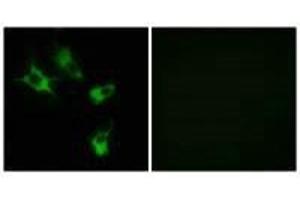 Immunofluorescence analysis of COS-7 cells, using MAST4 antibody. (MAST4 抗体)