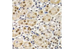 Immunohistochemistry of paraffin-embedded mouse kidney using ID3 antibody (ABIN5973111) at dilution of 1/200 (40x lens). (ID3 抗体)