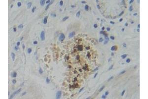 Immunohistochemistry (IHC) image for anti-phosphofructokinase, Platelet (PFKP) (AA 553-753) antibody (ABIN7434014)