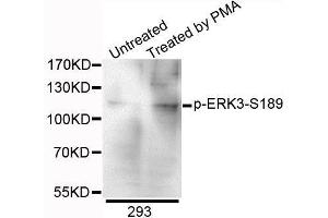 Western blot analysis of extracts of 293 cells, using Phospho-ERK3-S189 antibody. (MAPK6 抗体  (pSer189))