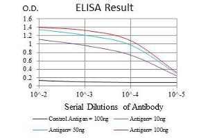 Black line: Control Antigen (100 ng), Purple line: Antigen(10 ng), Blue line: Antigen (50 ng), Red line: Antigen (100 ng), (Ubiquitin B 抗体)