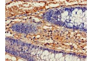 Immunohistochemistry (IHC) image for anti-Isocitrate Dehydrogenase 1 (NADP+), Soluble (IDH1) (AA 1-240) antibody (ABIN7157120)