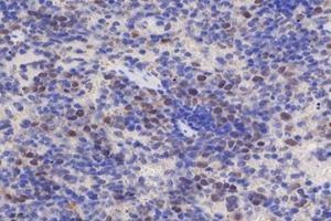 Immunohistochemistry analysis of paraffin-embedded mouse spleen using,EDD (ABIN7076102) at dilution of 1: 700 (UBR5 抗体)