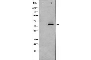 Western blot analysis of Akt2 expression in TNF-α treated A2780 whole cell lysates,The lane on the left is treated with the antigen-specific peptide. (AKT2 抗体  (C-Term))
