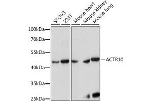 Western blot analysis of extracts of various cell lines, using  antibody (ABIN7265390) at 1:1000 dilution. (ACTR10 抗体  (AA 218-417))