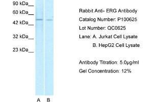 WB Suggested Anti-ERG  Antibody Titration: 1. (ERG 抗体  (Middle Region))