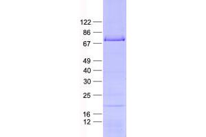 Validation with Western Blot (OSBPL9 Protein (His tag))