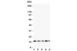 Western blot testing of TIA-1 antibody and Lane 1:  Jurkat (TIA1 抗体  (N-Term))