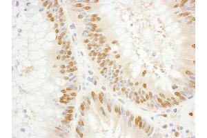 Immunohistochemistry (IHC) image for anti-General Transcription Factor IIE, Polypeptide 1, alpha 56kDa (GTF2E1) (AA 100-150) antibody (ABIN7454467)