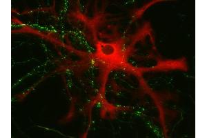 Immunocytochemistry (ICC) image for anti-phosphorylase, Glycogen, Brain (GPBB) (AA 826-842) antibody (ABIN1742514) (PYGB 抗体  (AA 826-842))