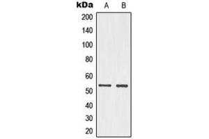 Western blot analysis of p53 (pS15) expression in HeLa UV-treated (A), PC12 (B) whole cell lysates. (p53 抗体  (N-Term, pSer15))
