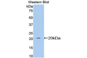 SIGLEC12 anticorps  (AA 27-141)