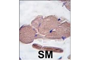 Formalin-fixed and paraffin-embedded human skeletal muscle tissue reacted with GDF8 antibody (N-term ) (ABIN388821 and ABIN2839139) , which was peroxidase-conjugated to the secondary antibody, followed by DAB staining. (MSTN 抗体  (N-Term))